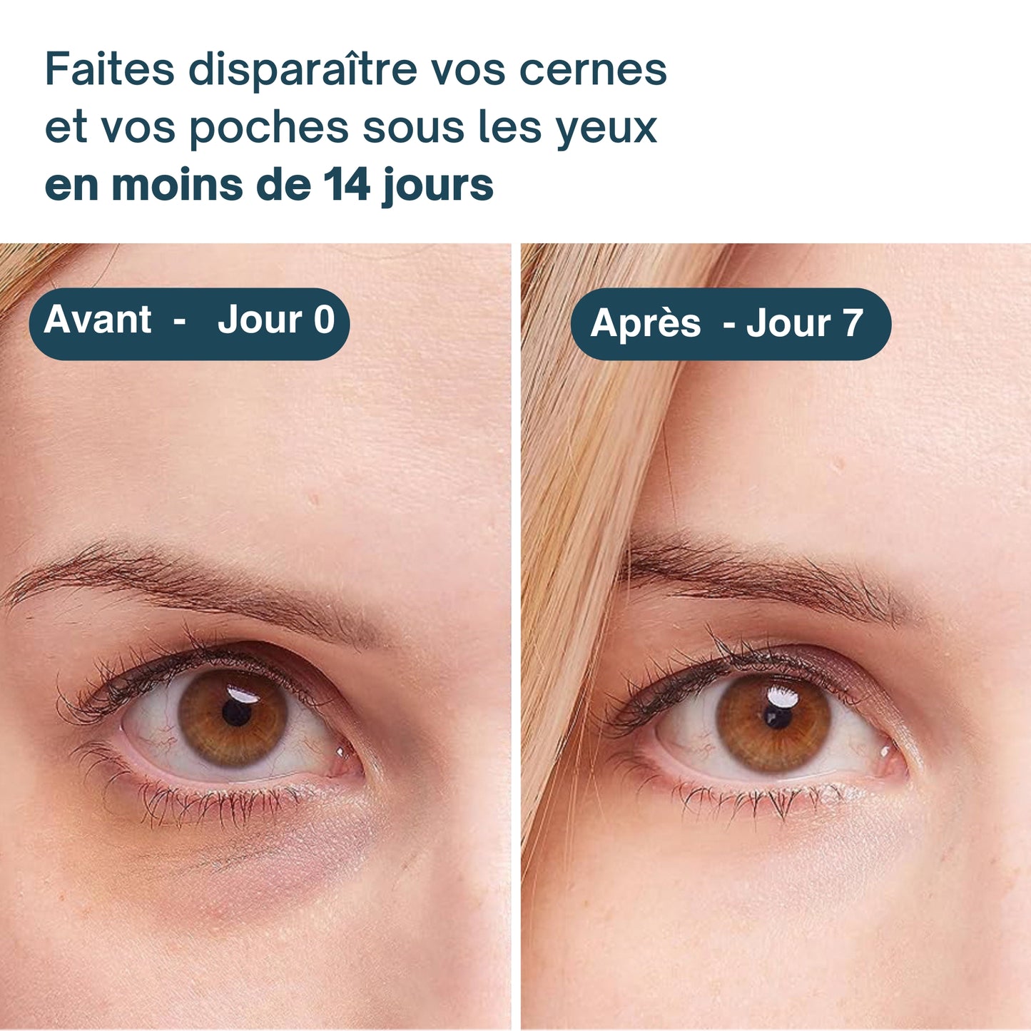 PATCH MICRO-AIGUILLES