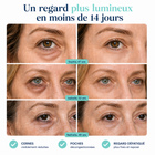 PATCH MICRO-AIGUILLES